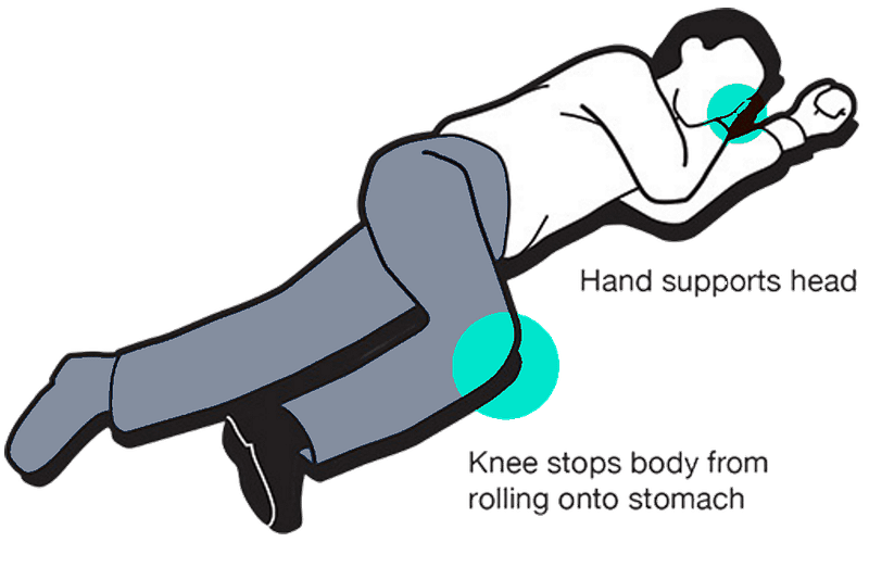 The Recovery Position: Hand Supports Head and Knee Stops Body Roll